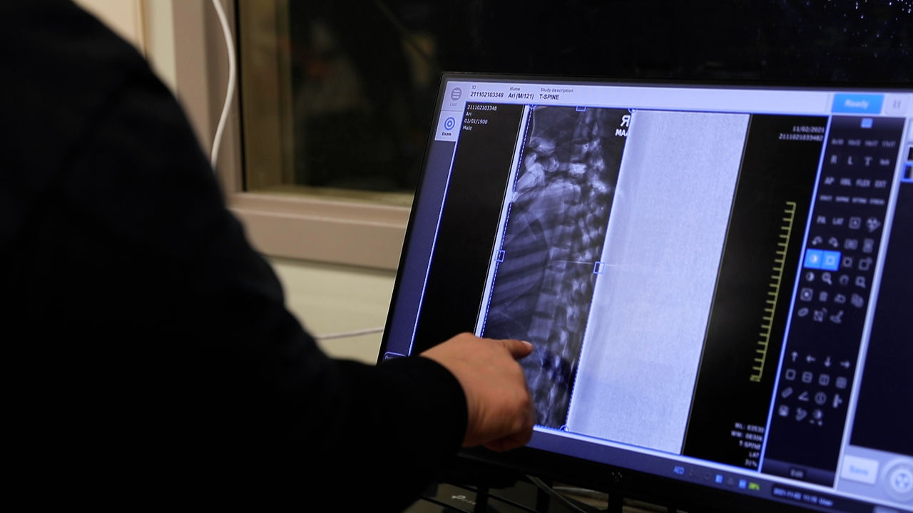 Medical professional analyzing spinal X-ray on monitor